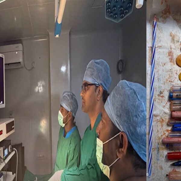 Medical Case in Andhra Pradesh: Pens and Wooden Spoons Found Inside Woman’s Stomach