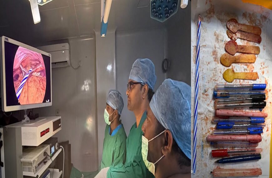 Medical Case in Andhra Pradesh Pens and Wooden Spoons Found Inside Woman’s Stomach